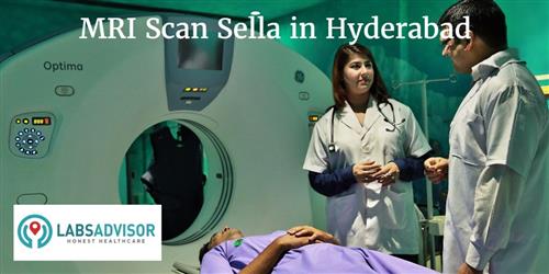 MRI Scan Sella Cost in Hyderabad - Get Up to 2% Discount in Best Lab(s