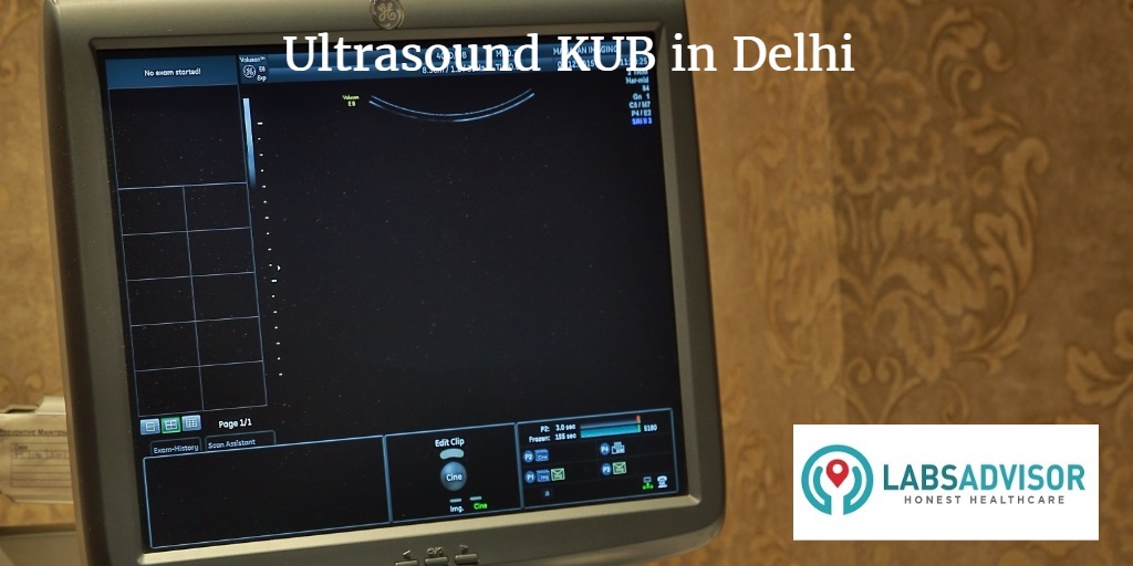Ultrasound KUB Cost in Delhi Get Up to 31 Discount in Best Lab(s